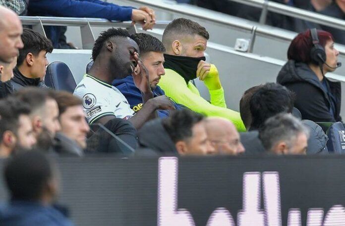 Hugo Lloris Kecam Fans Tottenham yang Soraki Davinson Sanchez (@DeportesEE)