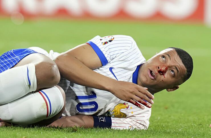 Cedera hidung Kylian Mbappe membuat Didier Deschamps cemas.
